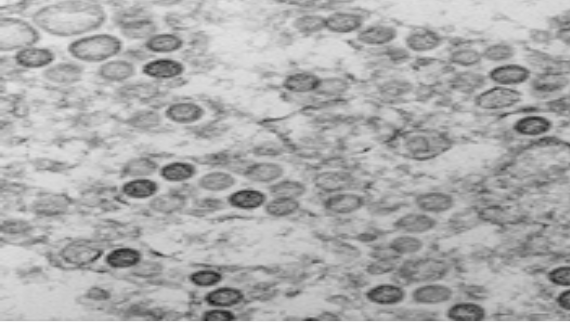 코로나 바이러스 전자현미경 형태.